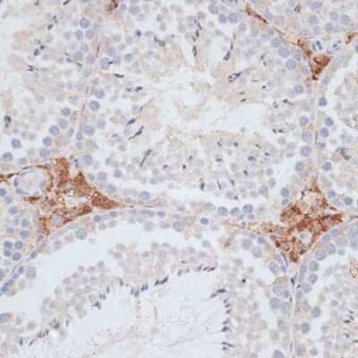 Immunohistochemistry-Paraffin: KIFC1 Antibody [NBP3-04585] - Paraffin-embedded mouse testis using KIFC1 antibody at dilution of 1:100 (40x lens).