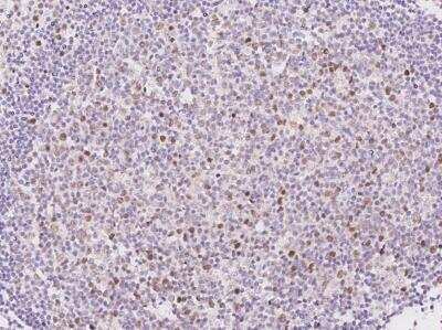 Immunohistochemistry-Paraffin: KIFC1 Antibody [NBP3-06407] - Immunochemical staining of human KIFC1 in human tonsil with rabbit polyclonal antibody at 1:500 dilution, formalin-fixed paraffin embedded sections.