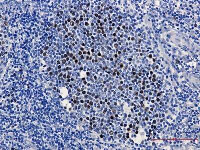 Immunohistochemistry-Paraffin: KIFC1 Antibody (S03-3E4) [NBP3-15052] - Immunohistochemistry of KIFC1 in paraffin-embedded Human tonsil using KIFC1 Rabbit mAb at dilution 1/2