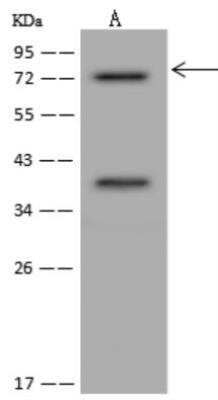 Western Blot: KIFC1 Antibody [NBP3-06407] - KIFC1 Antibody at 1:500 dilution. Lane A: HeLa Whole Cell Lysate. Lysates/proteins at 30 ug per lane. Secondary: Goat Anti-Rabbit IgG (H+L)/HRP at 1/10000 dilution. Developed using the ECL technique. Performed under reducing conditions. Observed band size:74 kDa.