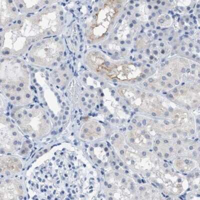 <b>Genetic Strategies Validation. </b>Immunohistochemistry-Paraffin: KIFC3 Antibody [NBP1-86021] - Staining of human kidney shows weak cytoplasmic positivity in cells in tubules.