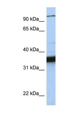 Western Blot: KIFC3 Antibody [NBP1-58178] - MCF-7 whole cell lysates, concentration 0.2-1 ug/ml.