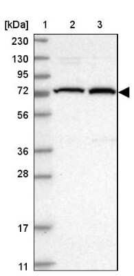 Western Blot: KIFC3 Antibody [NBP1-86021] - Lane 1: Marker  [kDa] 230, 130, 95, 72, 56, 36, 28, 17, 11.  Lane 2: Human cell line RT-4.  Lane 3: Human cell line U-251MG sp