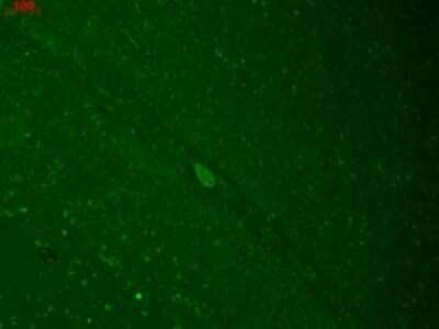 Immunocytochemistry/Immunofluorescence: KIR2.3 Antibody (S25-35) [NBP2-12902] - human hippocampal sections using this antibody.