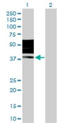 Western Blot KIR2DL3/CD158b2 Antibody