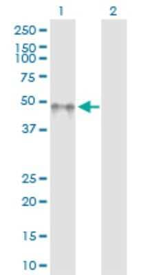 Western Blot: KIR2DL5/CD158f Antibody [H00057292-D01P] - Analysis of KIR2DL5A expression in transfected 293T cell line by KIR2DL5A polyclonal antibody.Lane 1: KIR2DL5A transfected lysate(41.25 KDa).Lane 2: Non-transfected lysate.