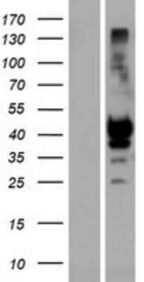 Western Blot: KIR2DS1 Overexpression Lysate (Adult Normal) [NBP2-07321] Left-Empty vector transfected control cell lysate (HEK293 cell lysate); Right -Over-expression Lysate for KIR2DS1.