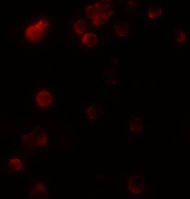 Immunocytochemistry/ Immunofluorescence KIR2DS2 Antibody - BSA Free