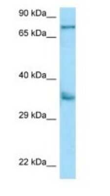 Western Blot: KIR2DS2 Antibody [NBP1-98548] - Titration: 1.0 ug/ml Positive Control: A549 Whole Cell.