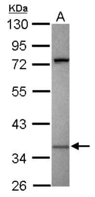 Western Blot: KIR2DS2 Antibody [NBP2-15004] - Sample (30 ug of whole cell lysate) A: Raji 10% SDS PAGE; antibody diluted at 1:1000.