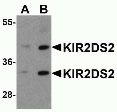 Western Blot KIR2DS2 Antibody - BSA Free