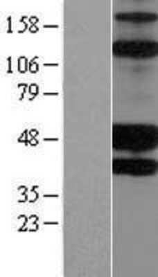 Western Blot KIR2DS2 Overexpression Lysate