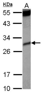 Western Blot: KIR2DS4 Antibody [NBP2-15006] - Sample (30 ug of whole cell lysate) A: Raji 12% SDS PAGE; antibody diluted at 1:1000.