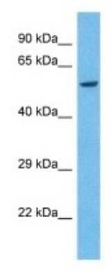 Western Blot: KIR2DS4/CD158i Antibody [NBP3-09976] - Western blot analysis of KIR2DS4/CD158i in Human HCT116 Whole Cell. Antibody dilution at 1 ug/mL