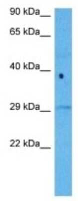 Western Blot: KIR2DS4/CD158i Antibody [NBP3-10034] - Western blot analysis of KIR2DS4/CD158i in Human Leiomyosarcoma Tumor lysates. Antibody dilution at 1ug/ml