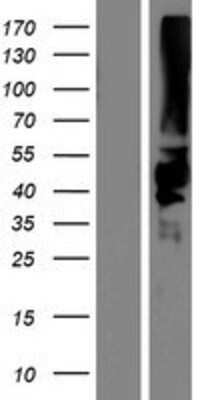 Western Blot KIR2DS5/CD158g Overexpression Lysate