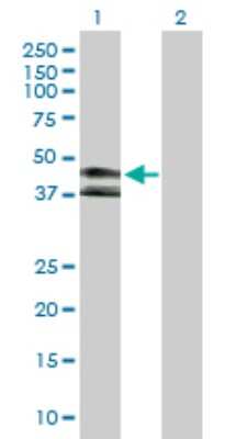 Western Blot: KIR3DL1 Antibody [H00003811-D01P] - Analysis of KIR3DL1 expression in transfected 293T cell line by KIR3DL1 polyclonal antibody.Lane 1: KIR3DL1 transfected lysate(42.40 KDa).Lane 2: Non-transfected lysate.