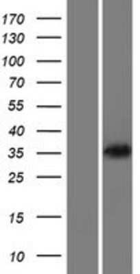 Western Blot KIR3DP1 Overexpression Lysate