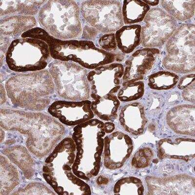 Immunohistochemistry-Paraffin KIR5.1 Antibody