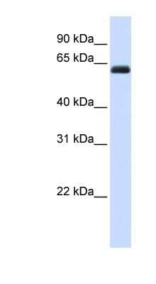 Western Blot: KIRREL2 Antibody [NBP1-59231] - Titration: 0.2-1 ug/ml, Positive Control: Human Liver.