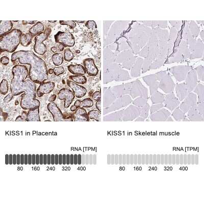 Immunohistochemistry-Paraffin: KISS1 Antibody [NBP2-34010] - Analysis in human placenta and skeletal muscle tissues. Corresponding KISS1 RNA-seq data are presented for the same tissues.