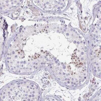 Immunohistochemistry-Paraffin: KISS1 Antibody [NBP2-34010] - Staining of human testis shows moderate perinuclear positivity in a subset of cells in seminiferous ducts.