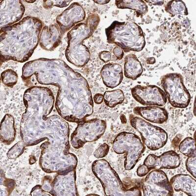 Immunohistochemistry-Paraffin: KISS1 Antibody [NBP2-34010] - Staining of human placenta shows strong cytoplasmic positivity in trophoblastic cells.