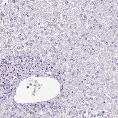 Immunohistochemistry-Paraffin: KISS1 Antibody [NBP2-34010] - Staining of human liver shows no positivity in hepatocytes as expected.