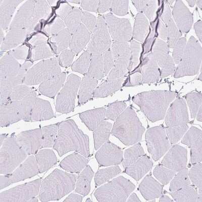 Immunohistochemistry-Paraffin: KISS1 Antibody [NBP2-34010] - Staining of human skeletal muscle shows no positivity in myocytes as expected.