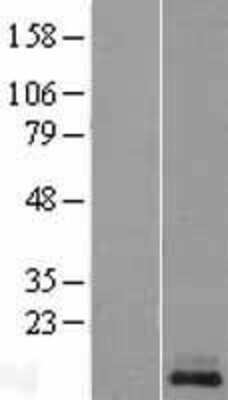 Western Blot: KISS1 Overexpression Lysate (Adult Normal) [NBL1-12305] Left-Empty vector transfected control cell lysate (HEK293 cell lysate); Right -Over-expression Lysate for KISS1.