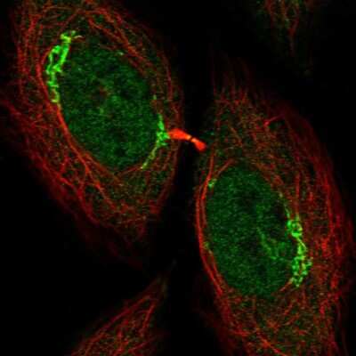 Immunocytochemistry/Immunofluorescence: KIST Antibody [NBP2-56531] - Staining of human cell line SiHa shows localization to nucleoplasm & the Golgi apparatus.