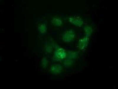 Flow Cytometry: KIST Antibody (OTI2H4) - Azide and BSA Free [NBP2-72383] - Staining of COS7 cells transiently transfected by pCMV6-ENTRY KIST.