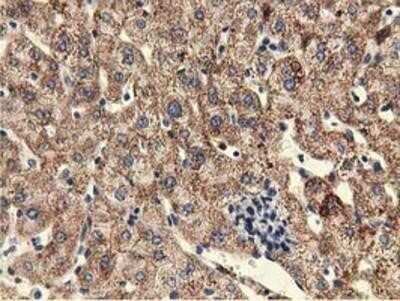 Immunohistochemistry: KIST Antibody (OTI2H4) - Azide and BSA Free [NBP2-72383] - Staining of paraffin-embedded Human liver tissue using anti-KIST mouse monoclonal antibody.