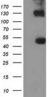 Western Blot: KIST Antibody (OTI2H4) - Azide and BSA Free [NBP2-72383] - HEK293T cells were transfected with the pCMV6-ENTRY control (Left lane) or pCMV6-ENTRY KIST (Right lane) cDNA for 48 hrs and lysed. Equivalent amounts of cell lysates (5 ug per lane) were separated by SDS-PAGE and immunoblotted with anti-KIST.