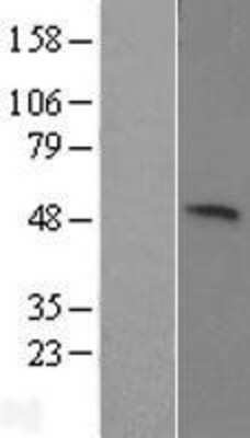 Western Blot KIST Overexpression Lysate