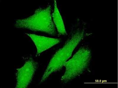 Immunocytochemistry/Immunofluorescence: KLC2 Antibody [H00064837-B01P] - Analysis of purified antibody to KLC2 on HeLa cell. (antibody concentration 10 ug/ml)