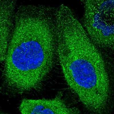 Immunocytochemistry/Immunofluorescence: KLC2 Antibody [NBP1-83723] - Staining of human cell line A-431 shows positivity in plasma membrane and cytoplasm. Antibody staining is shown in green.