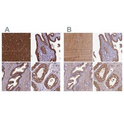 <b>Independent Antibodies Validation. </b>Immunohistochemistry-Paraffin: KLC2 Antibody [NBP1-83722] - Staining of human cerebral cortex, fallopian tube, prostate and testis using Anti-KLC2 antibody NBP1-83722 (A) shows similar protein distribution across tissues to independent antibody NBP1-83723 (B).