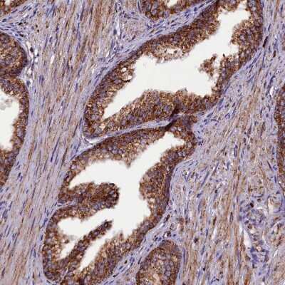 Immunohistochemistry-Paraffin: KLC2 Antibody [NBP1-83722] - Staining of human prostate shows strong granular cytoplasmic positivity in glandular cells.