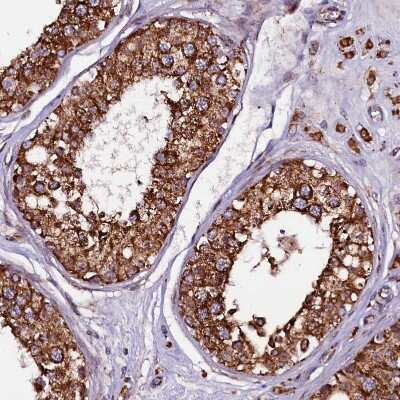 Immunohistochemistry-Paraffin: KLC2 Antibody [NBP1-83722] - Staining of human testis shows strong granular cytoplasmic positivity in cells in seminiferous ducts.