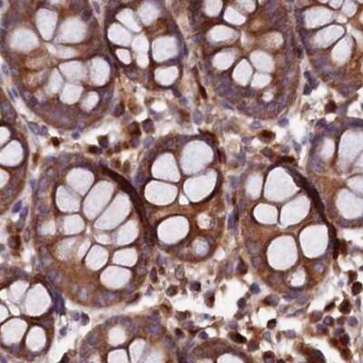 Immunohistochemistry-Paraffin: KLC2 Antibody [NBP1-83723] - Staining of human colon.