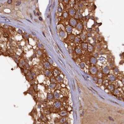 Immunohistochemistry-Paraffin: KLC2 Antibody [NBP1-83723] - Staining of human testis.