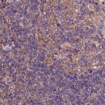 Immunohistochemistry-Paraffin: KLC2 Antibody [NBP1-83723] - Staining of human lymph node.