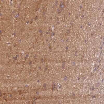 Immunohistochemistry-Paraffin: KLC2 Antibody [NBP1-83723] - Staining of human cerebral cortex shows moderate positivity in neuropil.