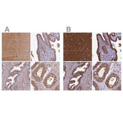 Immunohistochemistry-Paraffin: KLC2 Antibody [NBP1-83723] - Staining of human cerebral cortex, fallopian tube, prostate and testis using Anti-KLC2 antibody NBP1-83723 (A) shows similar protein distribution across tissues to independent antibody NBP1-83722 (B).