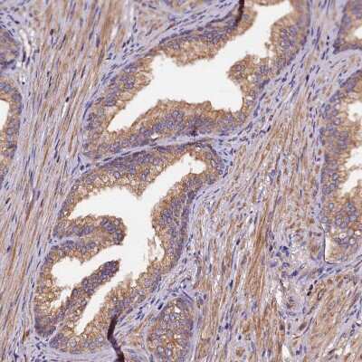 Immunohistochemistry-Paraffin: KLC2 Antibody [NBP1-83723] - Staining of human prostate shows moderate granular cytoplasmic positivity in glandular cells.