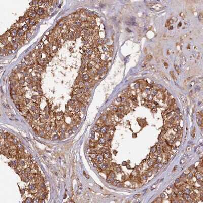 Immunohistochemistry-Paraffin: KLC2 Antibody [NBP1-83723] - Staining of human testis shows strong granular cytoplasmic positivity in cells in seminiferous ducts.