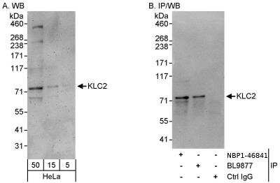 Immunoprecipitation: KLC2 Antibody [NBP1-46841] - Samples: Whole cell lysate (5, 15 and 50 ug for WB; 1 mg for IP, 20% of IP loaded) from HeLa cells. Antibodies: Affinity purified rabbit anti-KLC2 antibody used for WB at 0.04 ug/ml (A) and 0.4 ug/ml (B) and used for IP at 3 ug/mg lysate. KLC2 was also immunoprecipitated by rabbit anti-KLC2 antibody BL9877, which recognizes a downstream epitope. Detection: Chemiluminescence with exposure times of 3 minutes (A) and 30 seconds (B).