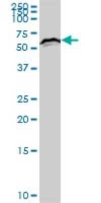 Western Blot: KLC2 Antibody [H00064837-B01P] - Analysis of KLC2 expression in rat brain.