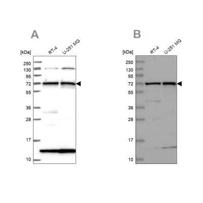 <b>Independent Antibodies Validation. </b>Western Blot: KLC2 Antibody [NBP1-83722] - Analysis using Anti-KLC2 antibody NBP1-83722 (A) shows similar pattern to independent antibody NBP1-83723 (B).